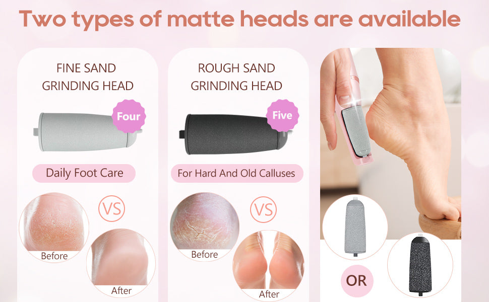 Electric Callus Remover