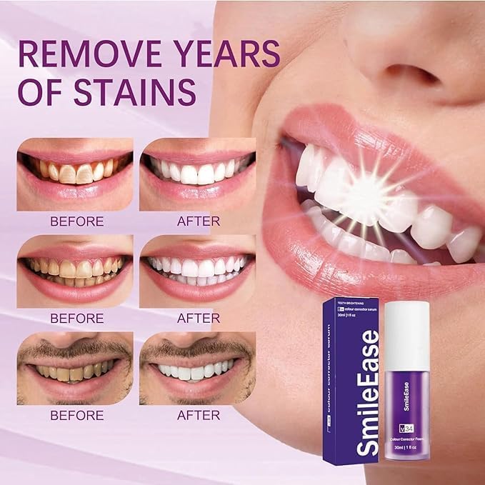 Purple Toothpaste for Teeth Whitening