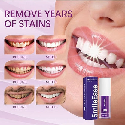 Purple Toothpaste for Teeth Whitening