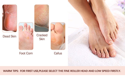 Electric Callus Remover