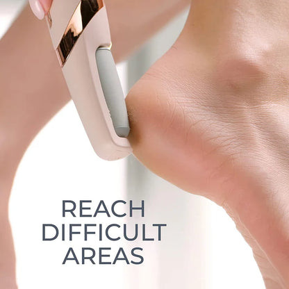 Electric Callus Remover